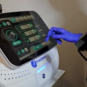 Microneedling RF Testimonial