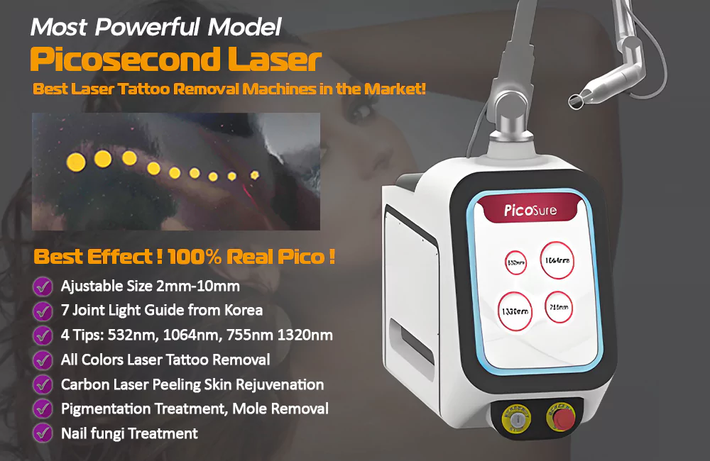 tattoo removal machine
